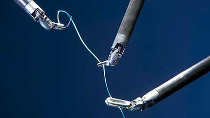 prostatectomia radical rarlp